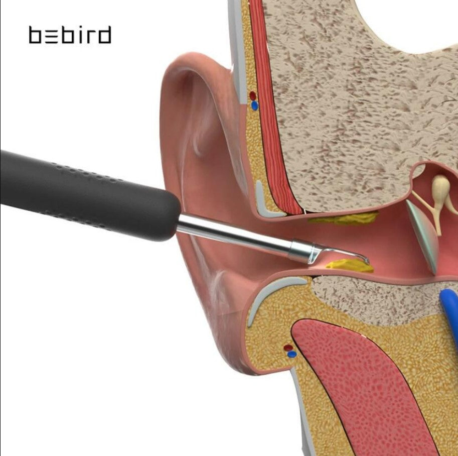 Bebird R1 Smart Visual Ear Sticks Endoscope Ear Picker Tool Set – Black_1